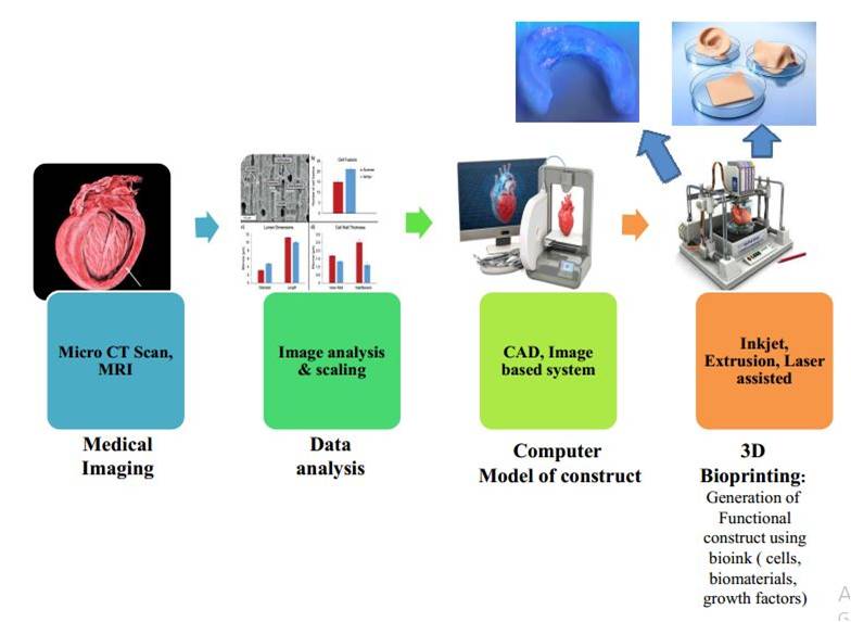 Bioprinting